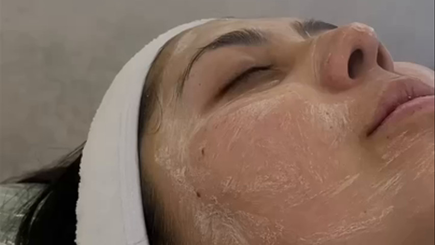 Tratamientos de Hidratación Facial