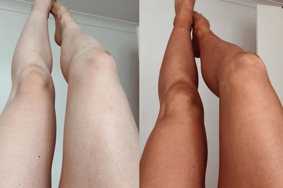 Antes y después bronceado